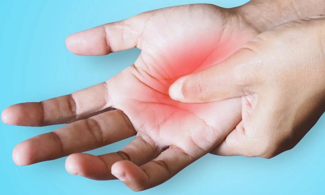 Síndrome do túnel do carpo