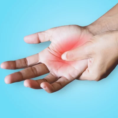 Síndrome do túnel do carpo